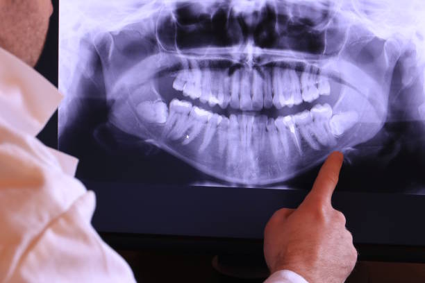 Urgent Tooth Repair in GA